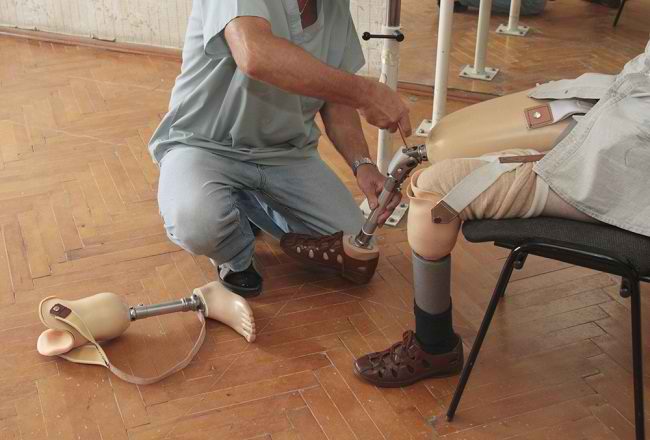 Prendersi cura di piedi protesici come avere piedi veri