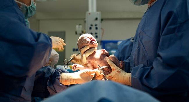Normal Doğum Sezar'a Karşı: Bunlar Yararları ve Riskleri