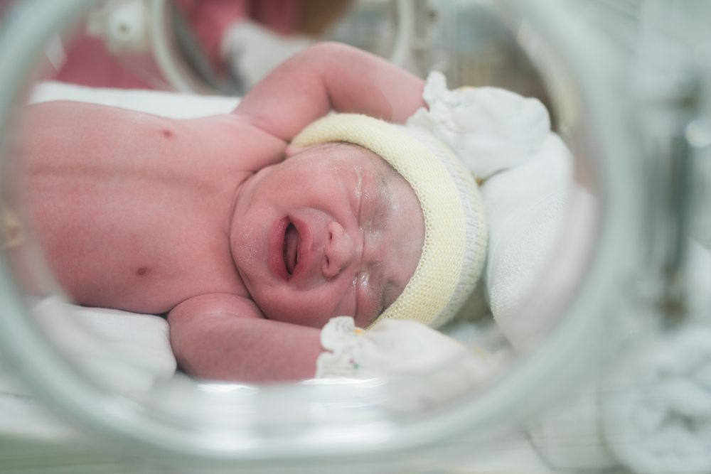 Syarat yang Memerlukan Resusitasi Bayi Baru Lahir