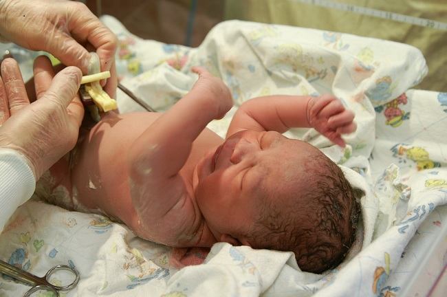 Fakta Mengenai Kelahiran Teratai dan Kemungkinan Risiko