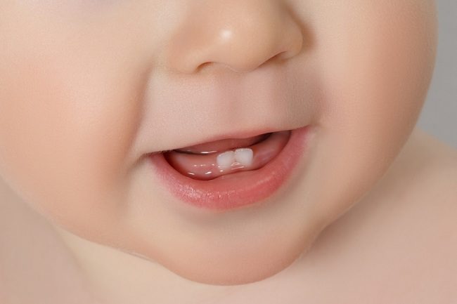 赤ちゃんの歯が生える苦情を克服するための解決策
