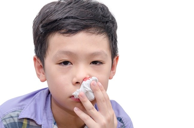 Бъдете внимателни, когато децата често кървят от носа
