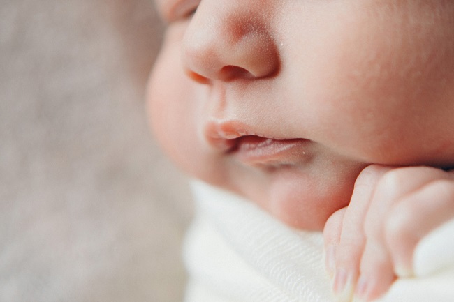 Напукани устни при новородени, опасно ли е?
