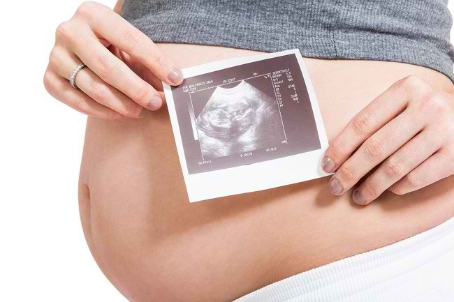 Мацерация за оценка на времето на детската смърт в утробата