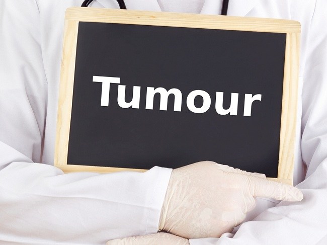 いくつかの一般的に使用される腫瘍治療と薬