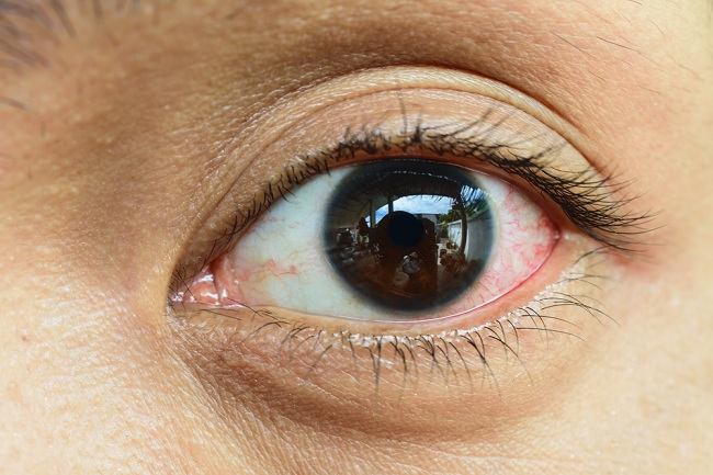 感染性眼痛の種類、治療、予防について知る