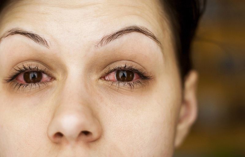 目の炎症の種類とそれを克服する方法