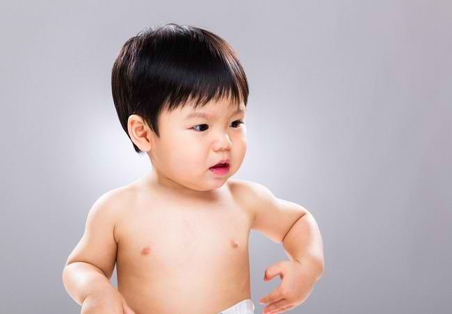 Разпознайте различни видове кожни алергии при бебета и деца