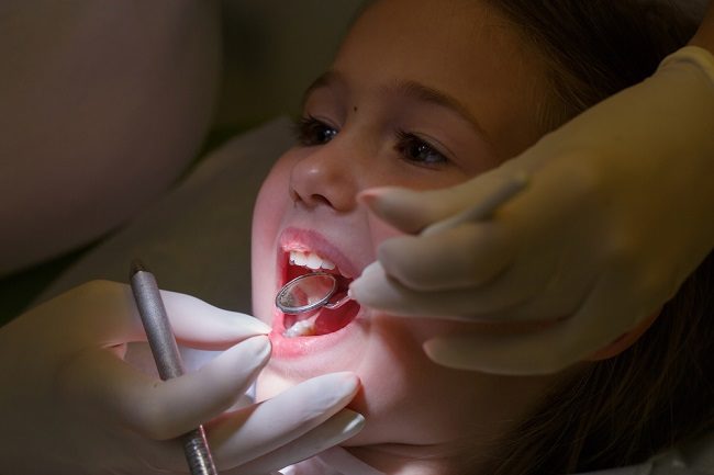هل يجب حشو التجاويف في الأسنان اللبنية؟