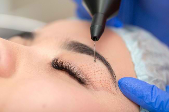 สิ่งที่คุณต้องรู้เกี่ยวกับการศัลยกรรมเปลือกตา